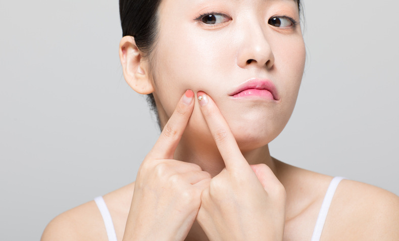 上班的时候整天戴着口罩,脸上的痘痘都加重了怎么办?