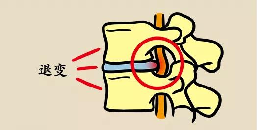 向生活“低头”?小心你的颈椎!