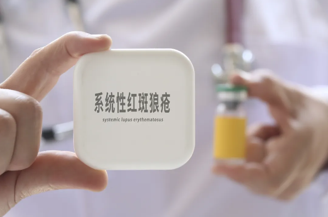 红斑狼疮是绝症吗?常规体检能否发现?你想了解的都在这里→