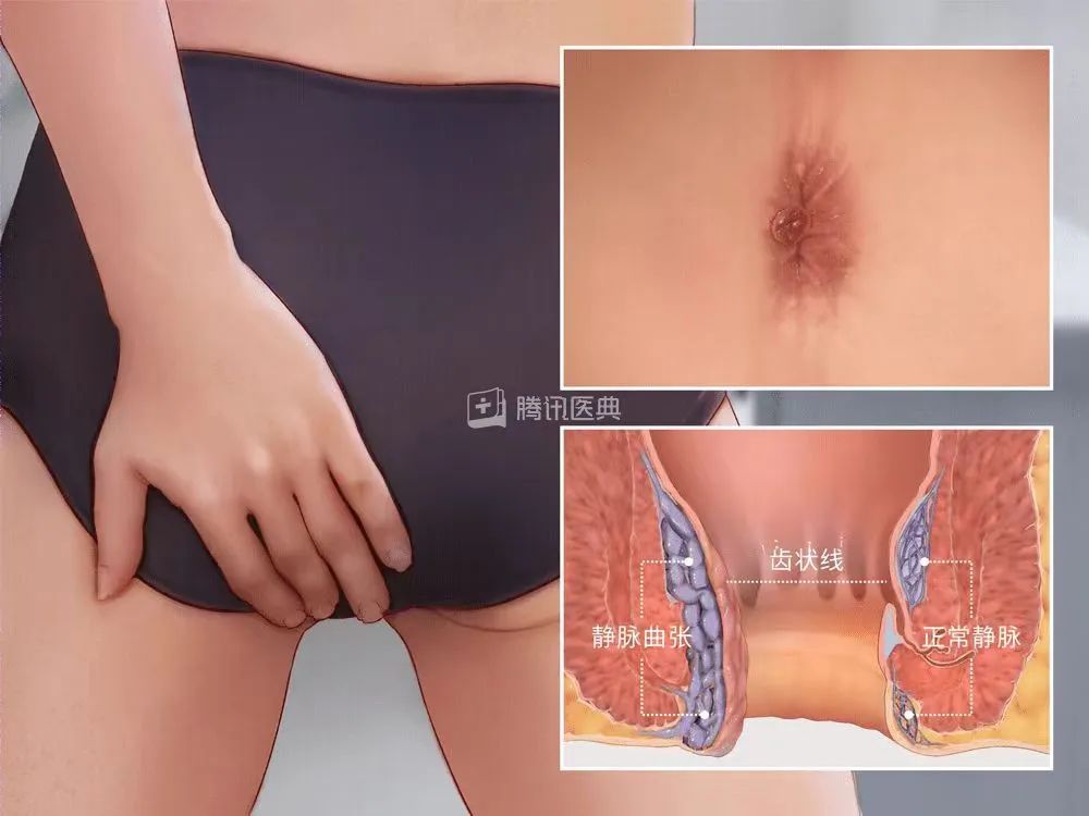 b22ef52e9dde2f17b54f718b9f50923c.jpg b22ef52e9dde2f17b54f718b9f50923c.jpg