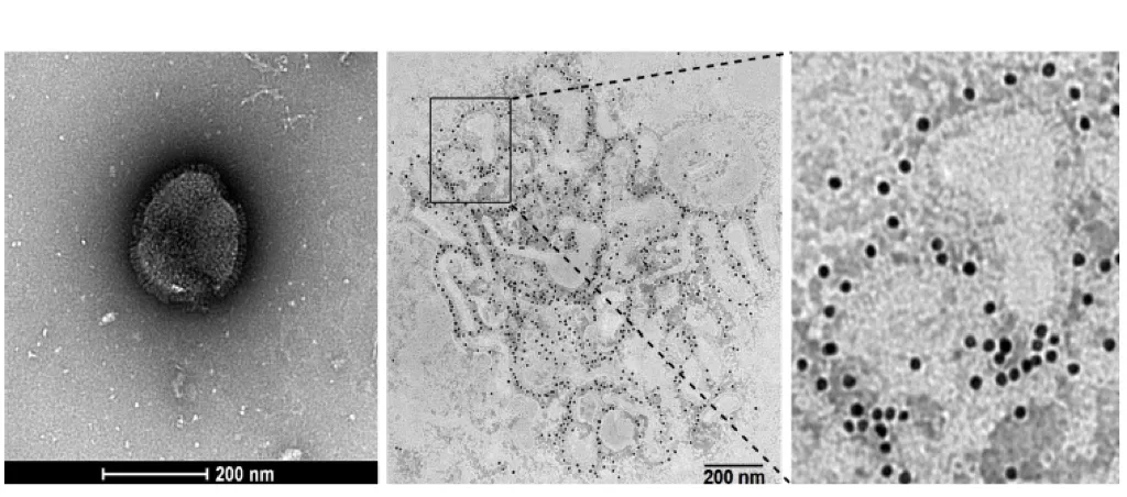 症状和流感相似？这种病毒来势汹汹，全人群普遍易感！