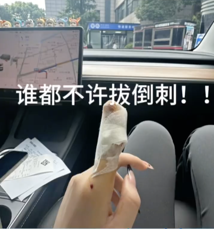 手上长倒刺，千万别直接拔！有人因此拔甲治疗