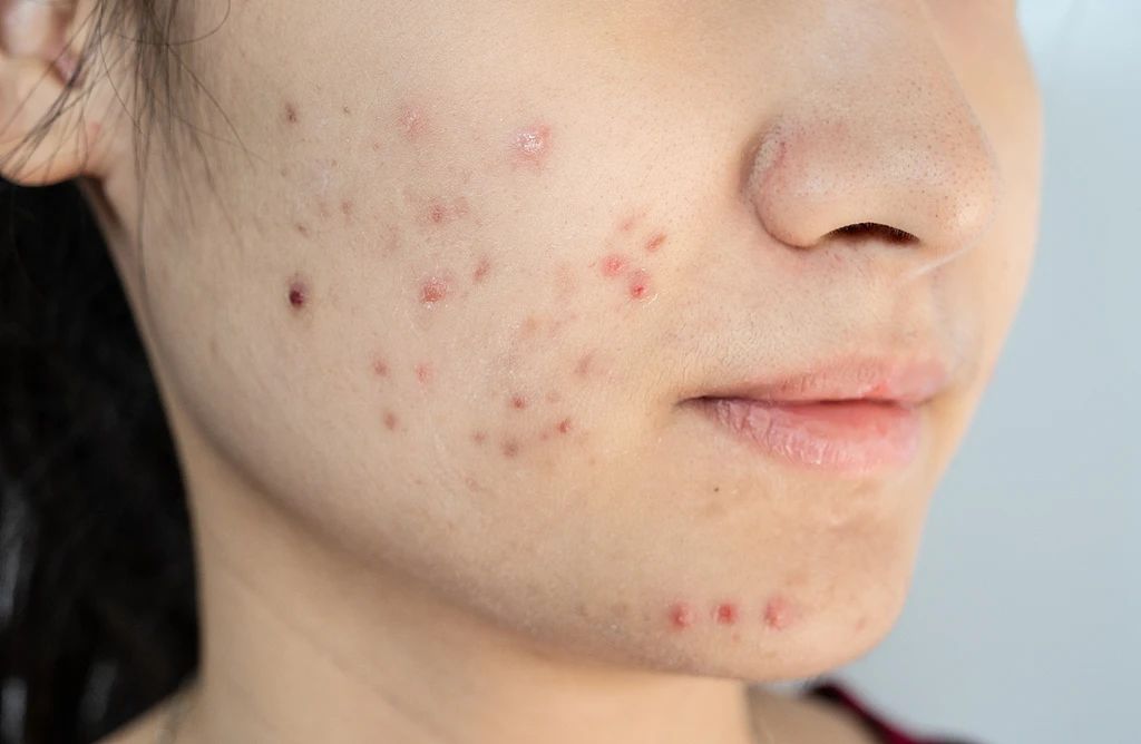 2fecbaa0f9da4a0f581ec0f84bb77b10.jpg 2fecbaa0f9da4a0f581ec0f84bb77b10.jpg