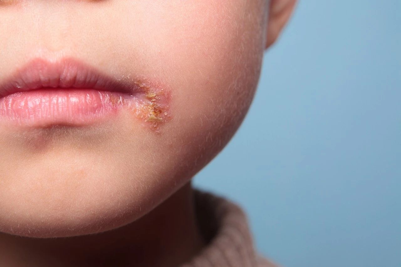 a21c064f4609728fd3ad1f0e4c671dcb.jpg a21c064f4609728fd3ad1f0e4c671dcb.jpg