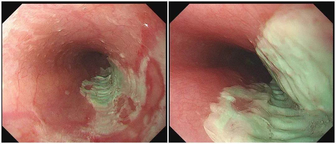 08dc225f5c81863536cd8ce41ea3eb82.jpg 08dc225f5c81863536cd8ce41ea3eb82.jpg