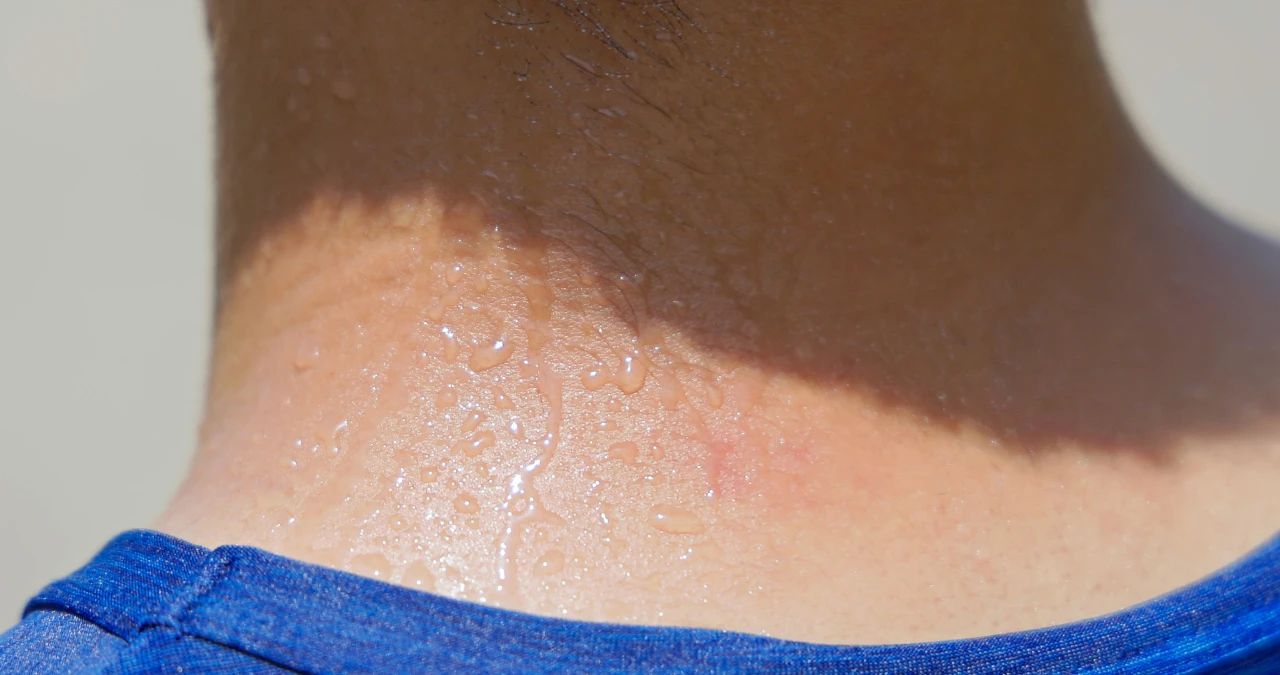 大汗淋漓时，别立刻做这些事！