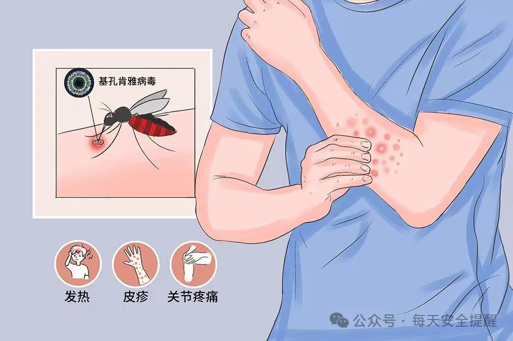 感染一次基孔肯雅热可终身免疫?回应来了