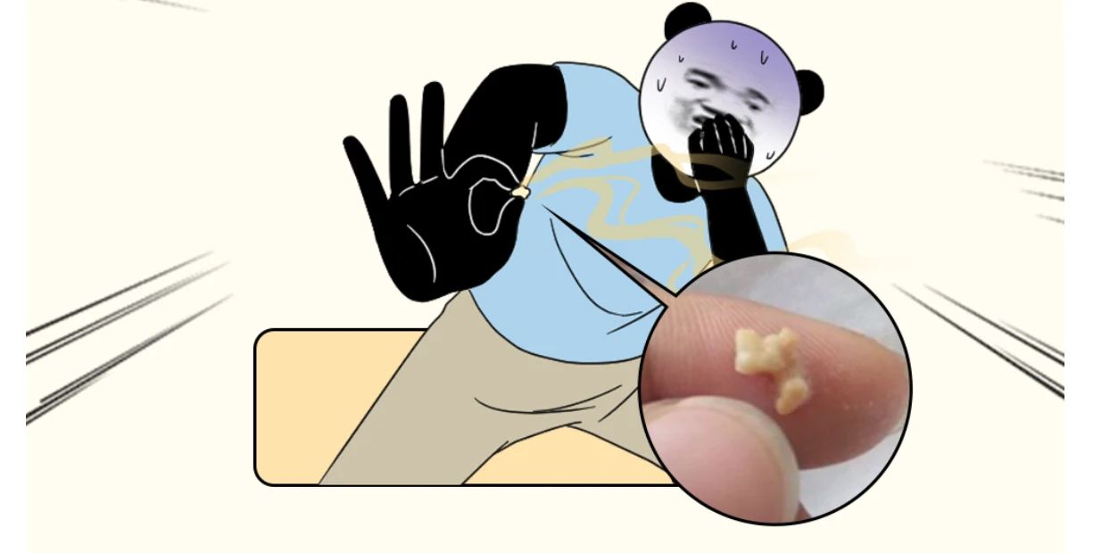 牙缝里抠出的臭臭,到底是啥?