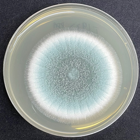 中招这种病菌,小心肺部“发霉”!这几类人群尤其要注意!