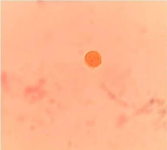 b9b75091bf97549c77a527ba893d7a30.jpg b9b75091bf97549c77a527ba893d7a30.jpg