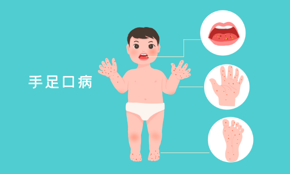 秋冬季传染病防控 | 防范手足口病,需要掌握这些知识