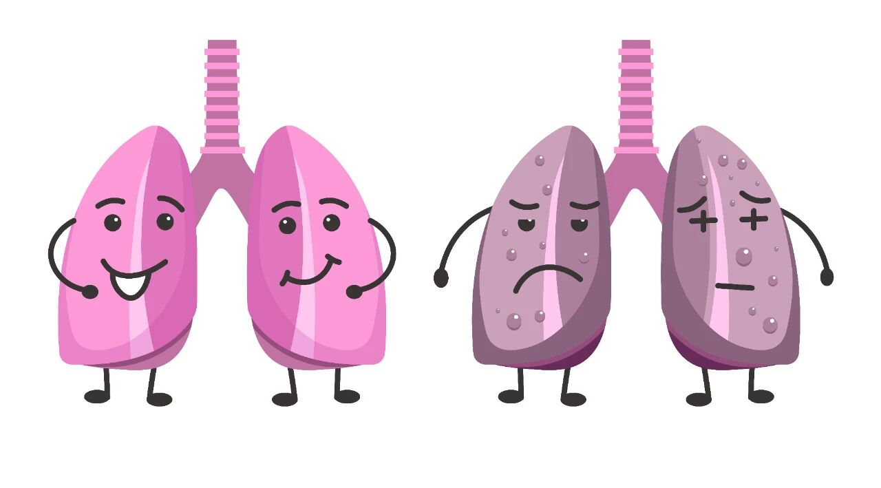 查出肺结节,“急着手术”并不明智